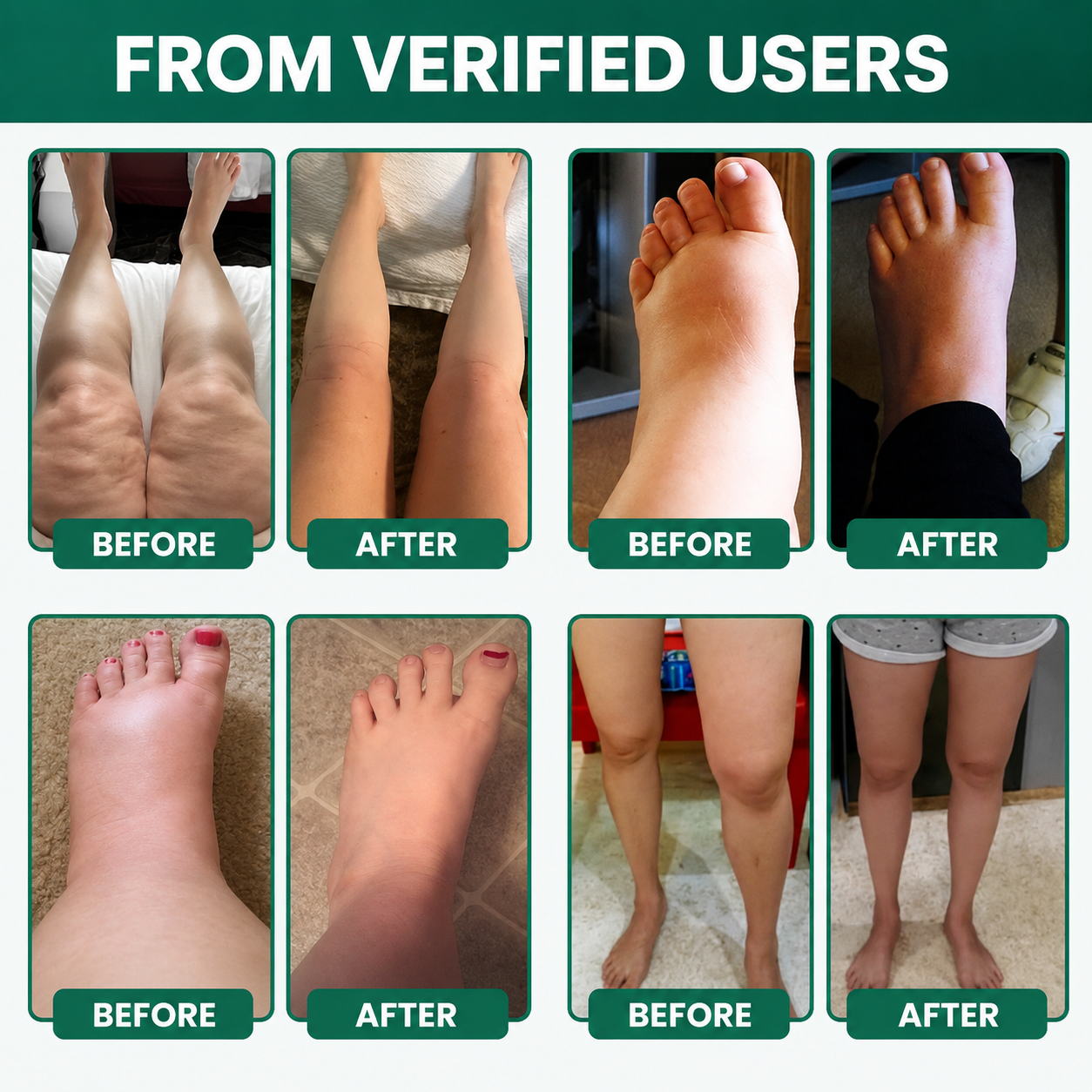 Lymphatic Drainage First Order