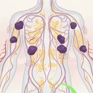 The Fluid Starts Moving. The Puffiness Starts to Fade.