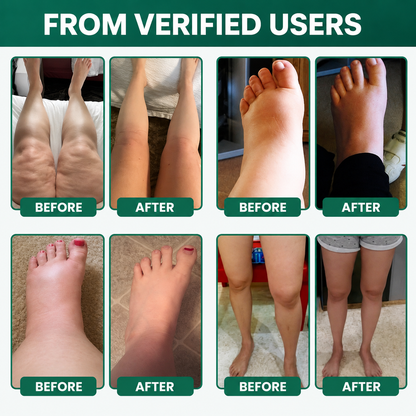 Lymphatic Drainage First Order